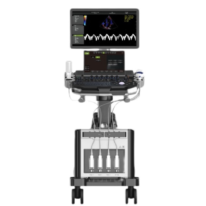 The AR-K70 Advanced Echo Cardiac Color Doppler Ultrasound Scanner